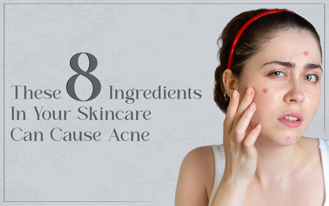 Skincare Can Cause Acne