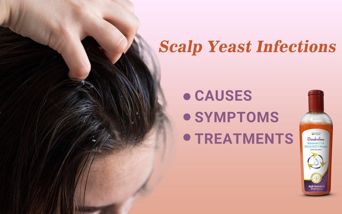 Scalp Yeast Infections