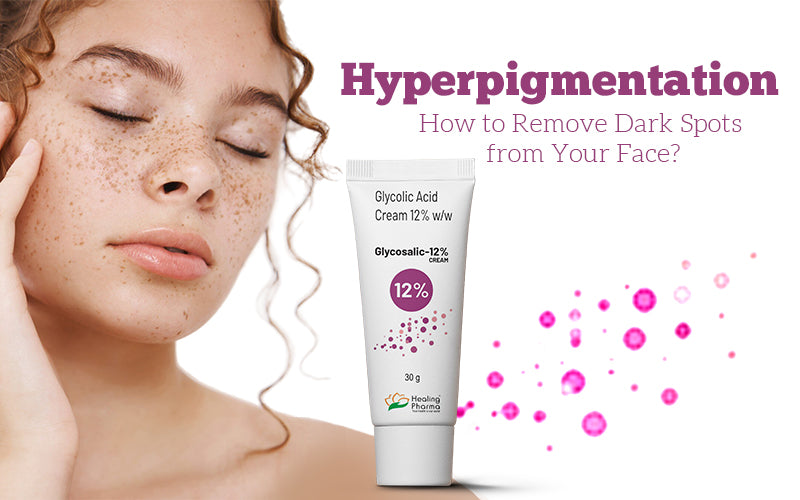 Hyperpigmentation