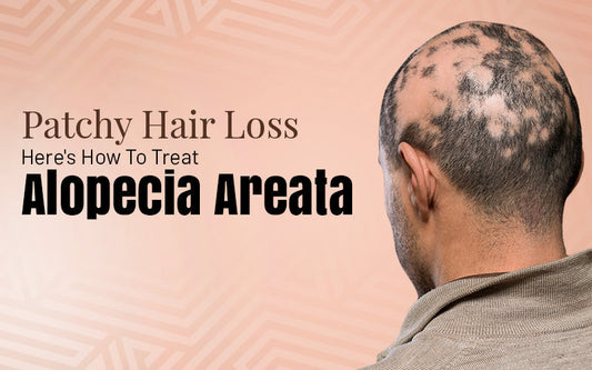 Patchy Hair Loss